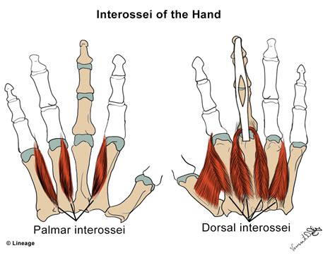 Intrinsic Hand Muscles - MSK - Medbullets Step 1