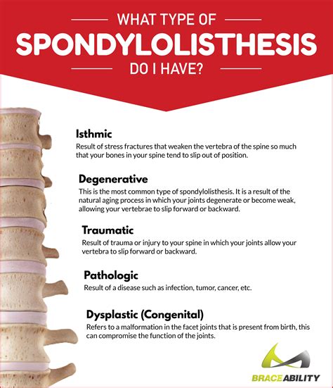 What type of spondylolisthesis do I have? There are five different ...