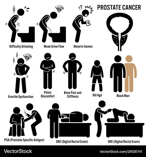 Prostate cancer symptoms causes risk factors Vector Image