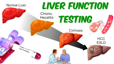 Clinical Approach To Elevated Liver Enzyme Activities