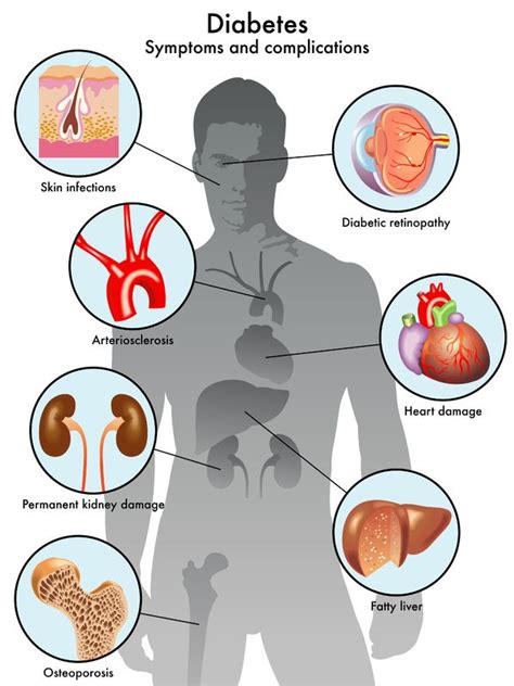 Diabetes and Vascular Disease