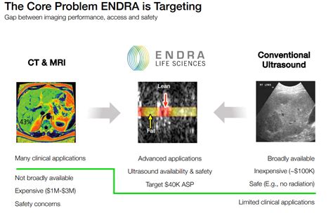 Endra Life Sciences: A Market Opportunity Coming Into Focus (NASDAQ ...