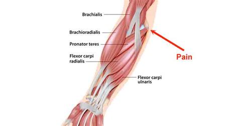 Elbow Muscles - Sportsinjuryclinic.net Origin, Insertion and Actions