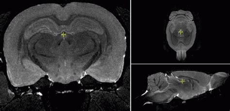 High res T2-weighted MRI of the rat brain (ex vivo) | BRAIN