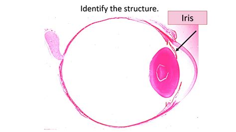 eye slides histology - anatomy of the eye - eye slides for practical ...