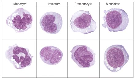 Monocyte morphology and maturation | Medical laboratory science ...