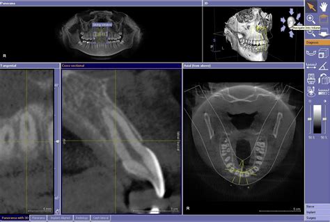 Cone Beam CT Imaging - Dentist Pasadena, TX | Dr. Nugent