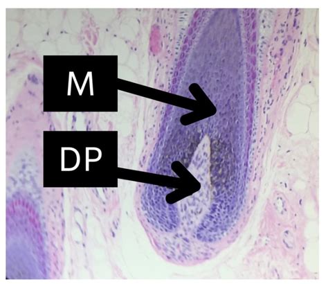 The Dermal Papilla: The Command Center of the Hair Follicle — Donovan ...