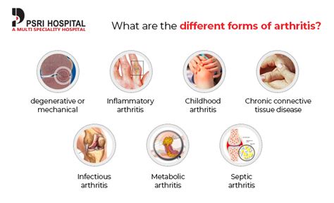 Arthritis: Symptoms, Causes, Types & Treatment - PSRI Hospital