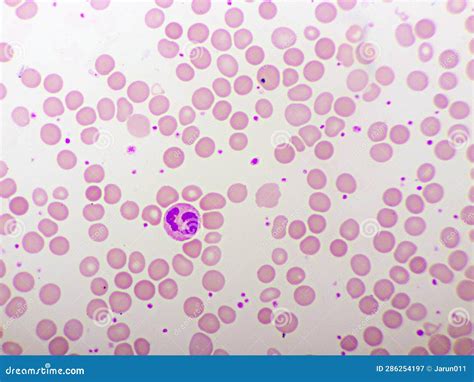 Segmented Neutrophil Cell in Human Blood Smear Stock Image - Image of ...