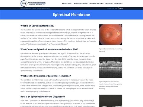 Epiretinal Membrane - Retina-Vitreous Surgeons of CNY