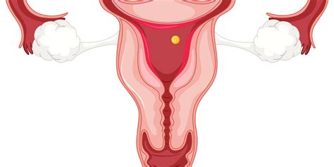 Endometrial Cancer – Symptoms & Causes – Dr. Deepa Ganesh