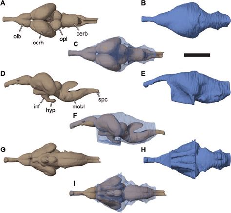 Three-dimensional renderings of the brain and endocast of the brain ...