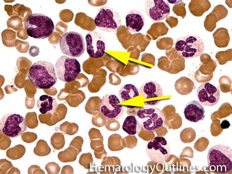 Hematopoiesis And Bone Marrow Histology Band Cell Histology Slide ...