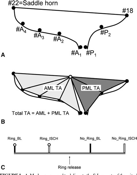 Figure 1 from Effects of different annuloplasty ring types on mitral ...