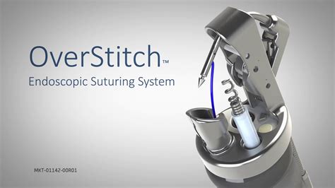 Overstitch Endoscopic Suturing System - YouTube