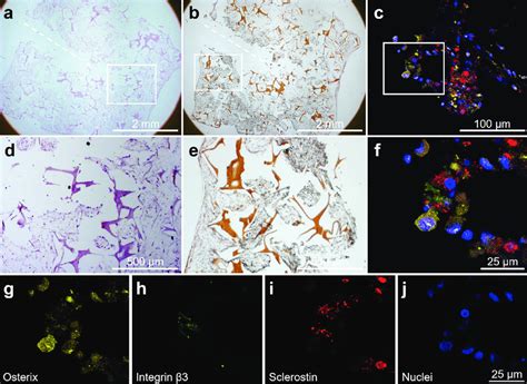 Cells expressing typical markers for osteoblasts, osteoclasts and ...