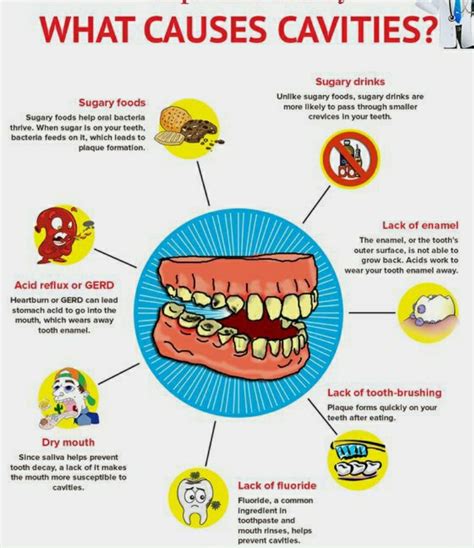 Dental Cavities Images, Dental Caries, Signs & Treatment