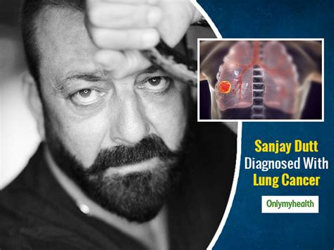 Breaking! Sanjay Dutt Diagnosed With Lung Cancer, Taking Break For ...