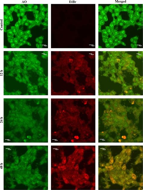 Acridine Orange/Ethidium Bromide (AO/EB) dual staining. Confocal ...