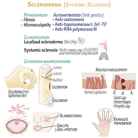 Scleroderma - Clinical Pathology Flashcards | ditki medical and ...