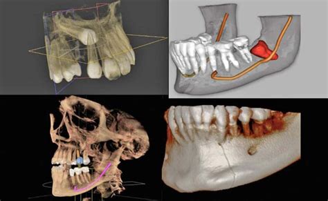 Cone Beam dental ¿para qué sirve? | Dr. Fernández