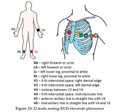 [DIAGRAM] 15 Lead Ekg Placement Diagram - MYDIAGRAM.ONLINE