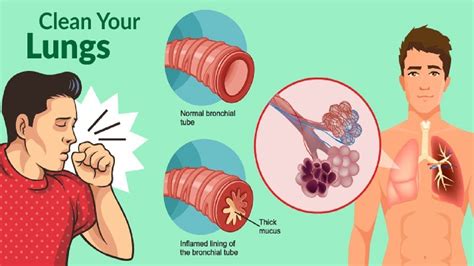 Get Rid of Phlegm and Mucus in Chest & Throat Instantly - Health Cares