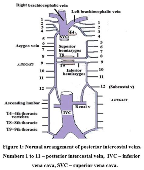 Posterior Intercostal Veins