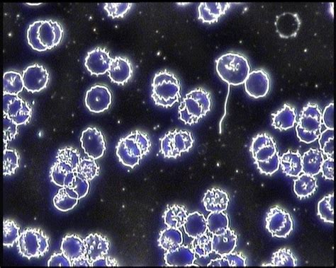 Pleomorphism and Germ Theory Explained - Live Blood Online