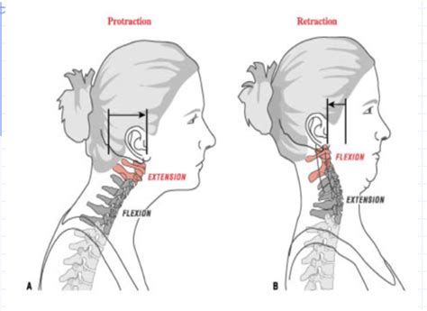 Spinal Lecture 2 Flashcards | Quizlet