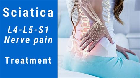 L4-L5-S1 Sciatica Pain | Sciatic nerve pain | Treatment of sciatica ...