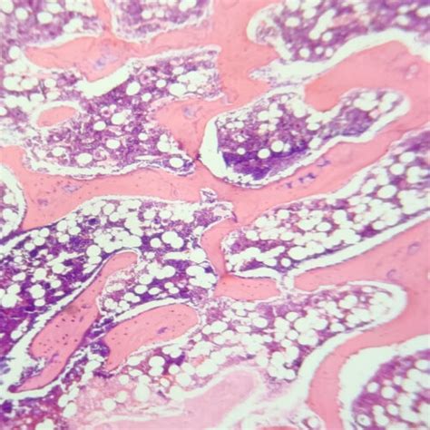 Cancellous bone, also called trabecular or spongy bone, H.E. Stain ...