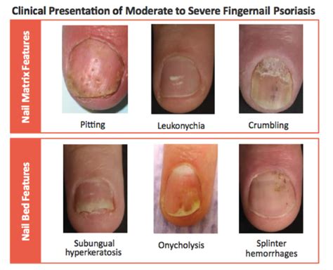 Which skin disease is it? - MEDizzy Journal