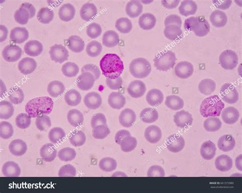 Plasmodium Microscope Slide