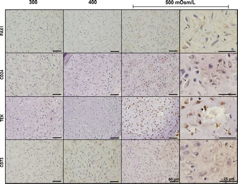 Nucleus Pulposus Cells