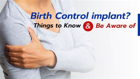 Birth Control implant? Things to Know & Be Aware of | Chiangmai ...