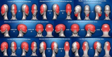 Headache Chart, Location, and Symptoms For Headaches Types