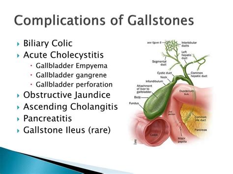 PPT - Gallstone Disease and Acute Cholecystitis PowerPoint Presentation ...