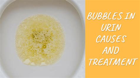 Learn Reason of having Bubbles In Urine and Is It Ok for Health?