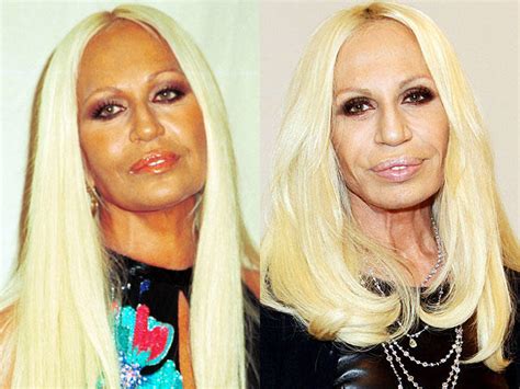 Noroeste inoxidável Alabama donatella versace before plastic surgery ...