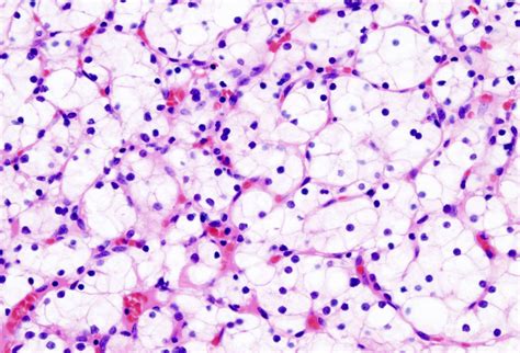 Hematoxylin and Eosin (H&E) Staining : Principle, Procedure and ...