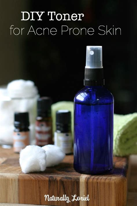 DIY Toner for Acne Prone Skin - Naturally Loriel | Recipe | Diy toner ...