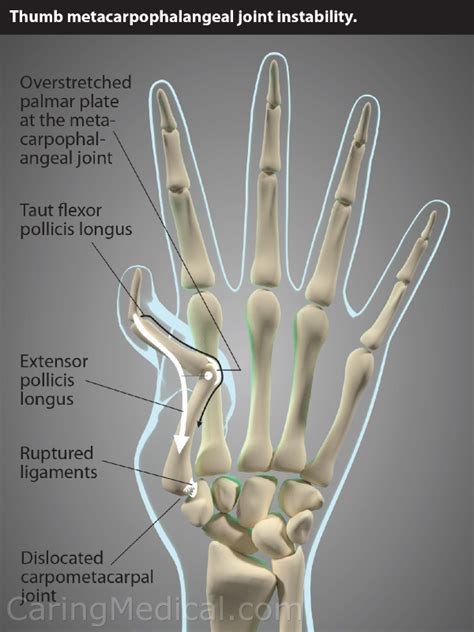 Joints Of Thumb