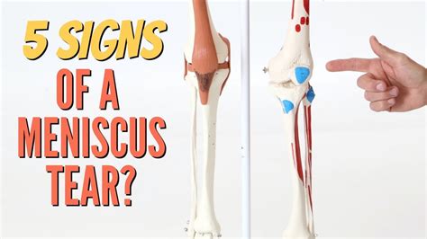 5 Signs Your Knee Pain is a Meniscus Tear-Self-Tests (Cartilage) Updated