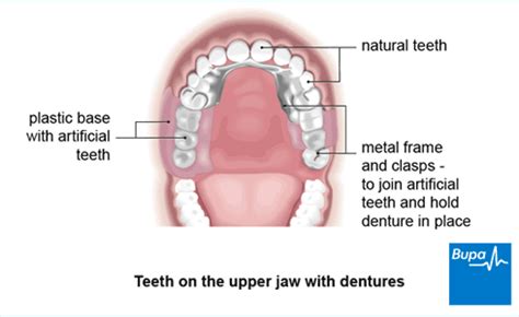 False Teeth Options - Dental News Network