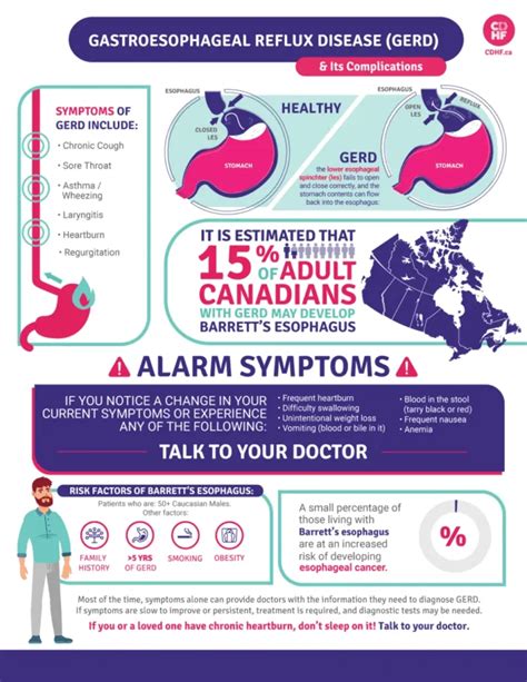 What is GERD and what complications can arise from it? - Canadian ...