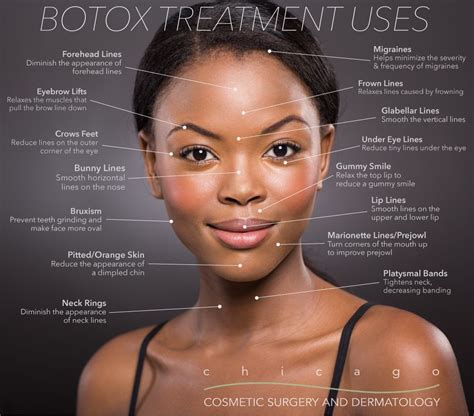 Botox dysport jeuveau xeomin – Artofit