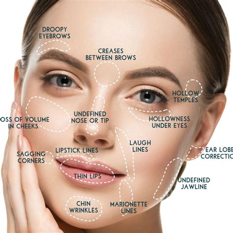 Dermal Fillers in Dayton, Ohio | Under Eye & Face Fillers in Dayton ...