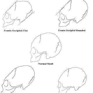 Cranial modification styles | Download Scientific Diagram